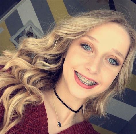 blonde girl with braces|braces are pretty